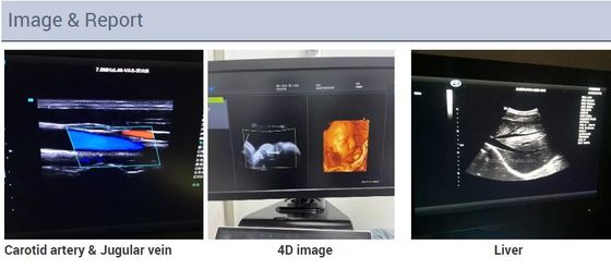 2D 3D 4D Echocardiography รถเข็นหัวใจ Echo Color Doppler Ultrasound Machine