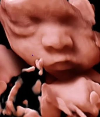 3D 4D 5D Color Doppler Ultrasound Trolley Ultrasound Scanner สำหรับ OB GYN