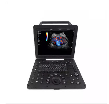 โรคหัวใจและหลอดเลือดเครื่องสแกนเนอร์อัลตราซาวนด์ Doppler สีเต็มรูปแบบแบบพกพา